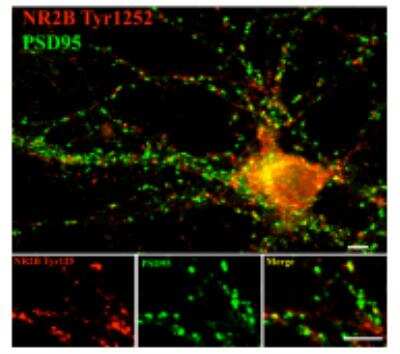 Immunohistochemistry: Synaptotagmin-1 [p Thr202] Antibody [NB300-235] - Immunostaining of 14 DIV rat cortical neurons showing synaptotagmin when phosphorylated at Thr202 in red and PSD95 in green. Photo courtesy of Gang Liu. 